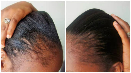 Hair Growth Oil